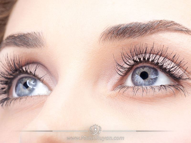 دلایل افتادگی پلک و درمان خانگی